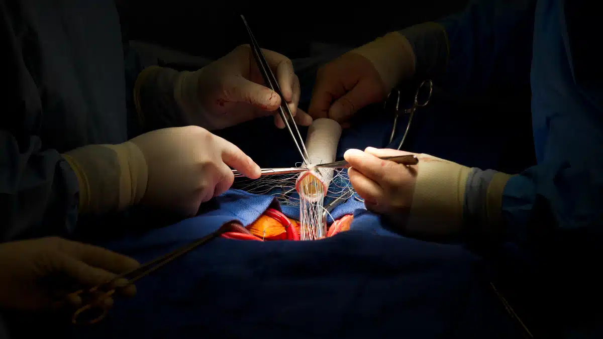 Cirurgia Cardíaca