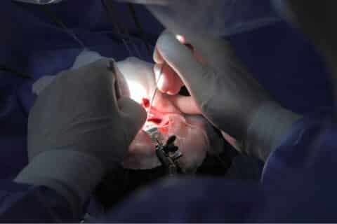 Cirurgia neurológica