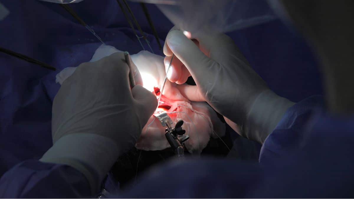 Cirurgia neurológica