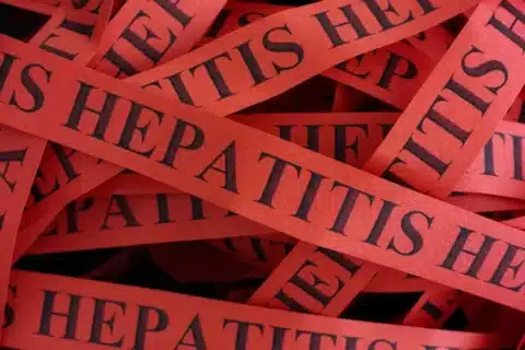 Hepatite A