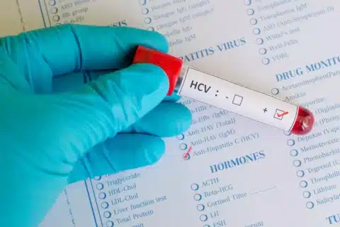 Hepatite c - figado