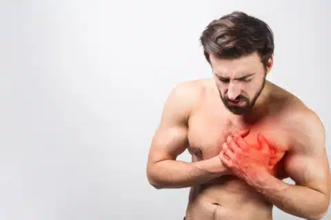 Infarto Agudo do Miocárdio (IAM)