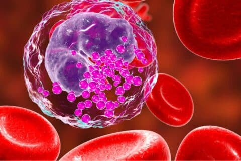 Leucemia