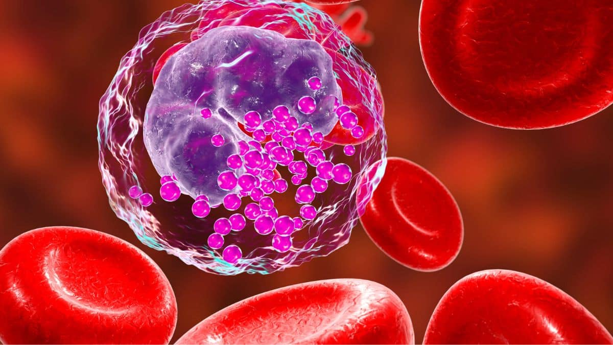 Leucemia