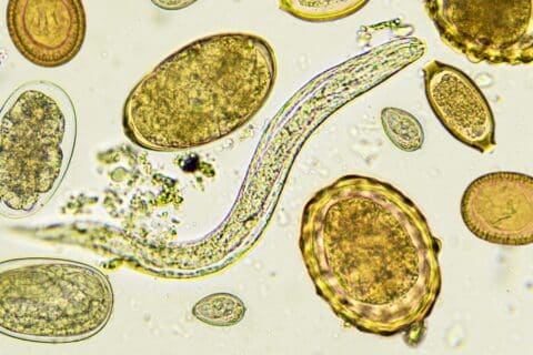 O que são Doenças Infecciosas e Parasitárias?