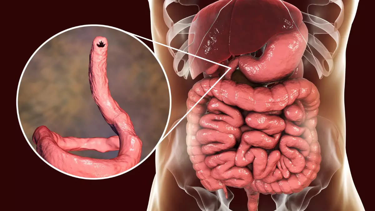 Parasitoses Intestinais na Gravidez