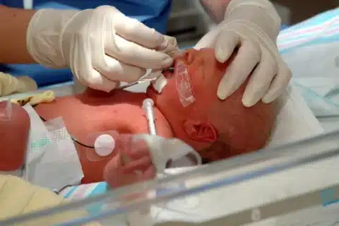 Prevenção do Tétano Neonatal - Imunização