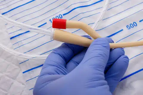 A sondagem vesical é a introdução de uma sonda ou cateter na bexiga, que pode ser realizada através da uretra ou por via supra-púbica, e tem por finalidade a remoção da urina.