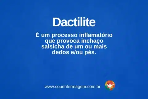 Dactilite - termo técnico de enfermagem