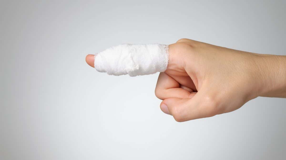 Dicas Simples para Tratar Pequenos Cortes: Cuidados Essenciais e Prevenção de Infecções
