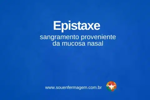 Epistaxe - termo técnico de enfermagem