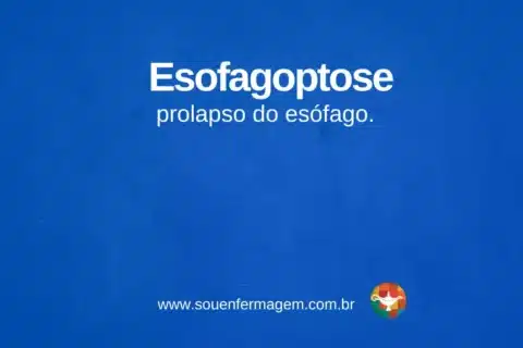 Esofagoptose - termo técnico de enfermagem