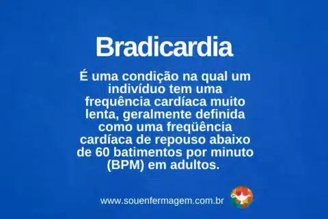 bradicardia - Termo técnico de enfermagem
