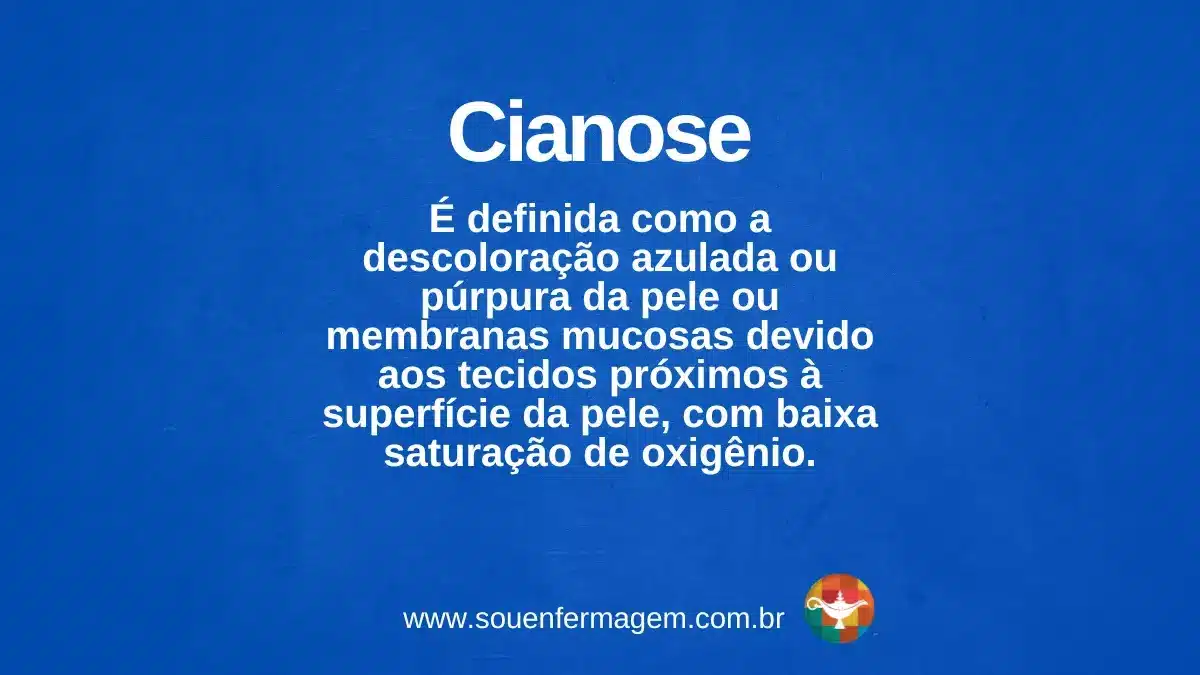 Cianose - termo técnico de enfermagem