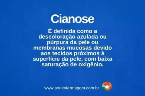 Cianose - termo técnico de enfermagem