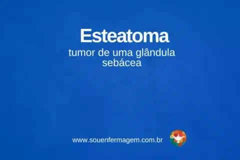 Esteatoma - termo técnico de enfermagem