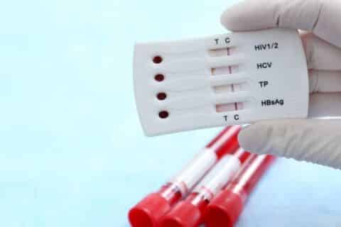 A sífilis é uma Infecção Sexualmente Transmissível (IST) curável