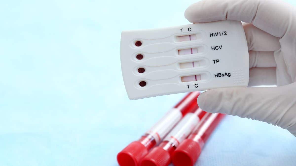 A sífilis é uma Infecção Sexualmente Transmissível (IST) curável