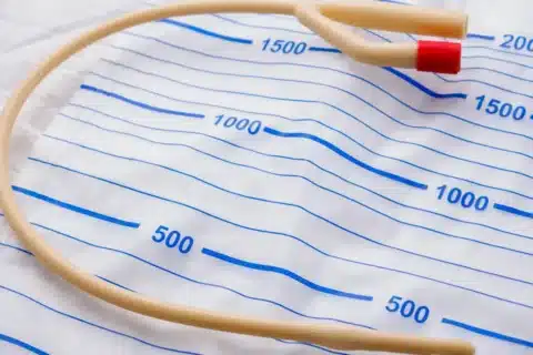 Complicações da Sonda Vesical de Demora