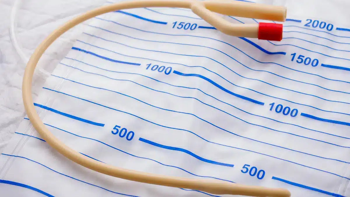 Complicações da Sonda Vesical de Demora