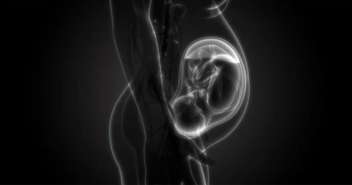 A evolução da enfermagem obstetrícia e da humanização do parto - A evolução da enfermagem obstetrícia e da humanização do parto -