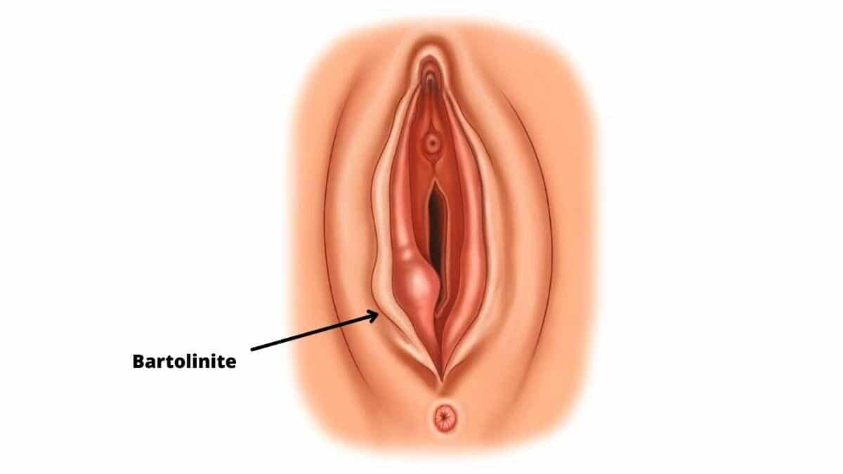 bartolinite