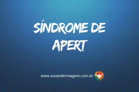 Síndrome de Apert
