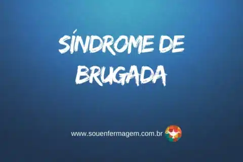 Síndrome de Brugada