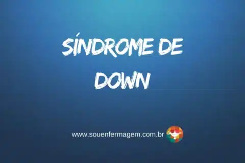Síndrome de Down