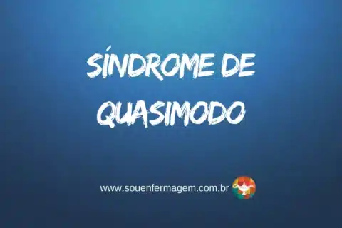 Síndrome de Quasimodo