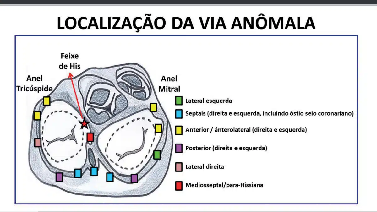 A Análise do Ritmo Cardíaco