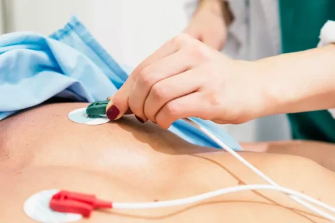 Análise da Repolarização Ventricular
