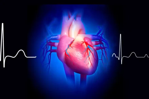 Análise do ECG nas Coronariopatias