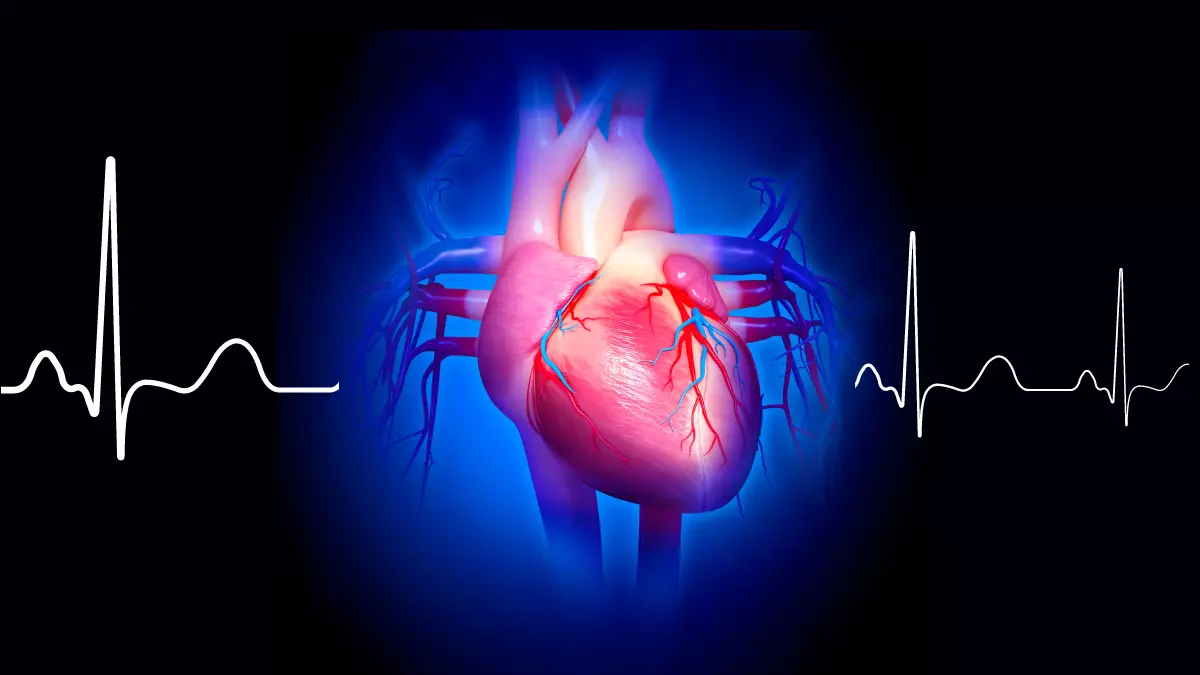 Análise do ECG nas Coronariopatias