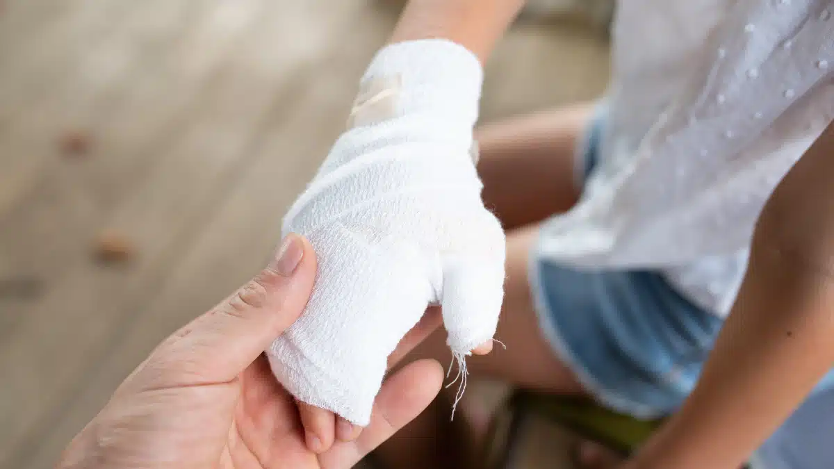 Bebê que teve picada de inseto na cabeça teve o dedo amputado em hospital