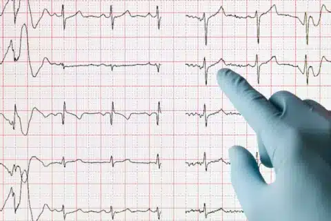 Caracterização das Alterações Eletrocardiográficas em Situações Clínicas Específicas