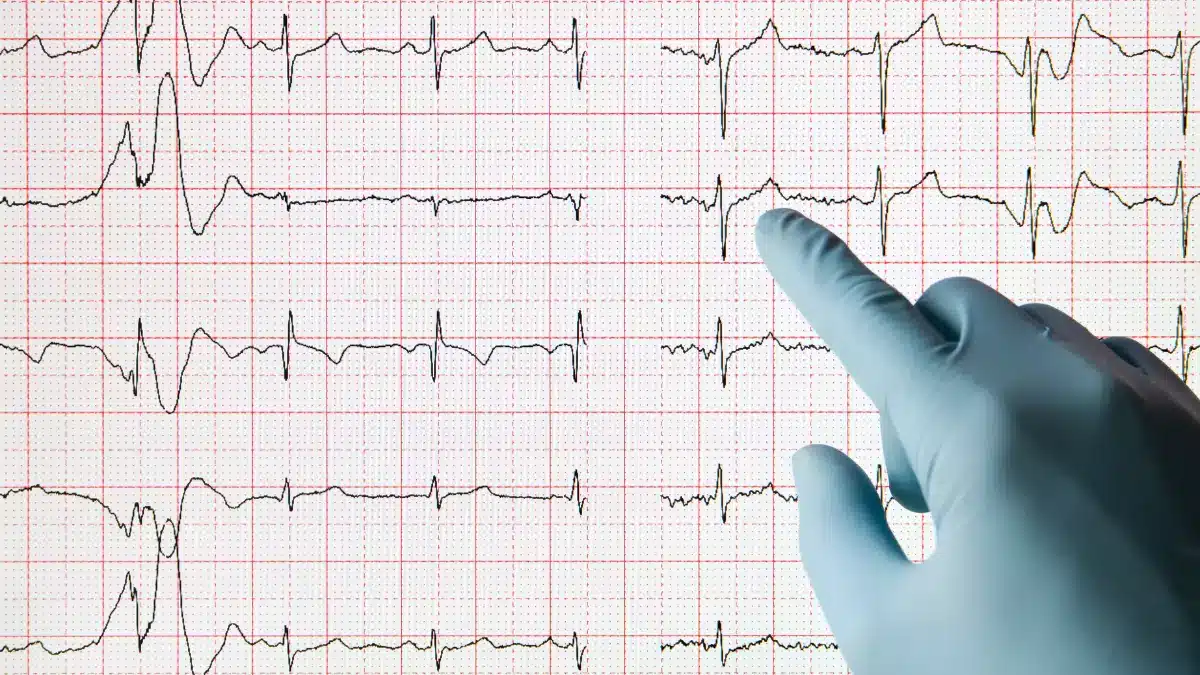 Caracterização das Alterações Eletrocardiográficas em Situações Clínicas Específicas
