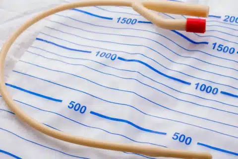 Cuidados de enfermagem antes da passagem da sonda vesical de demora SVD