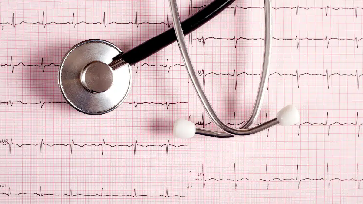 Eletrocardiograma (ECG)