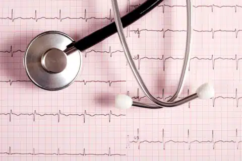 Eletrocardiograma (ECG)