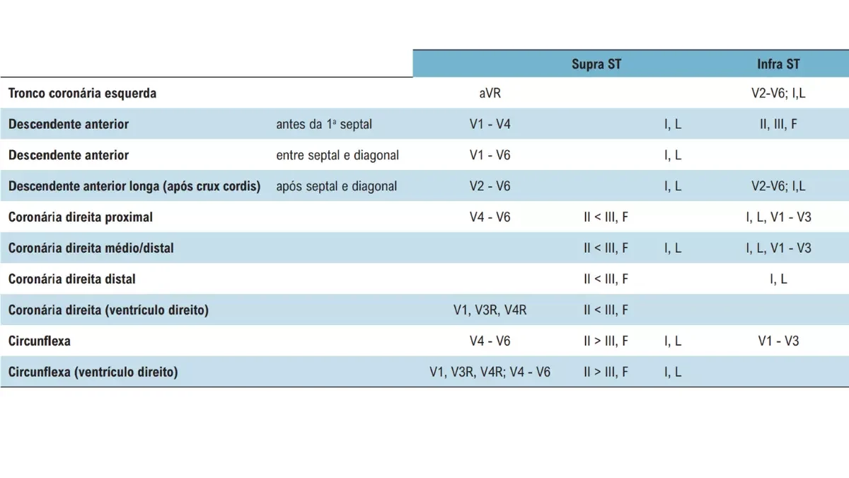 Figura 1 - Correlação entre derivações eletrocardiográficas e artéria culpada