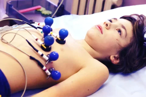 O ECG em Crianças