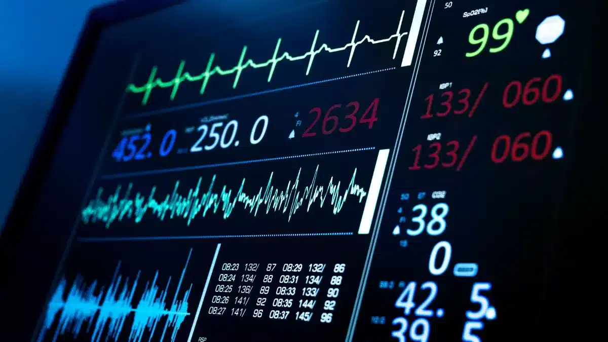 Tele-eletrocardiografia
