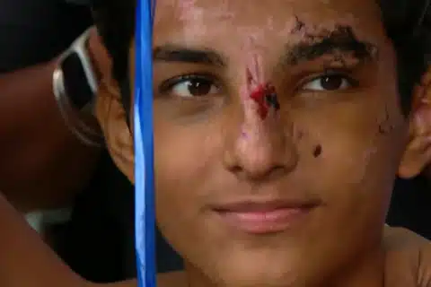 Adolescente Christian Lima Corrêa de 16 anos, deixa hospital após 15 dias de internação