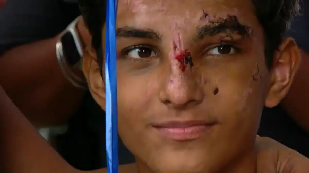Adolescente Christian Lima Corrêa de 16 anos, deixa hospital após 15 dias de internação
