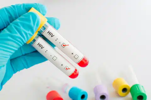 Como NÃO se transmite HIV?