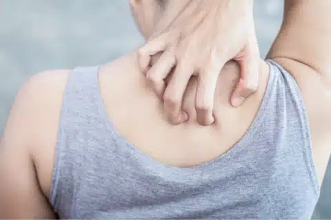 Evolução de Enfermagem: Coleta de Linfa para Hanseníase