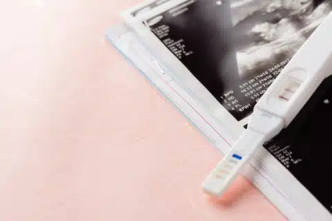 Teste imunológico para gravidez (TIG)