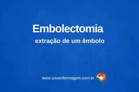 Embolectomia - extração de um êmbolo