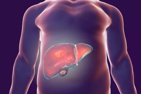 Hepatite D: Vida, Tratamento e Prevenção